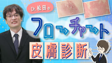 CareNeTVオリジナル　Dr.松田のフローチャート皮膚診断