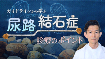 ガイドラインから学ぶ尿路結石症診療のポイント