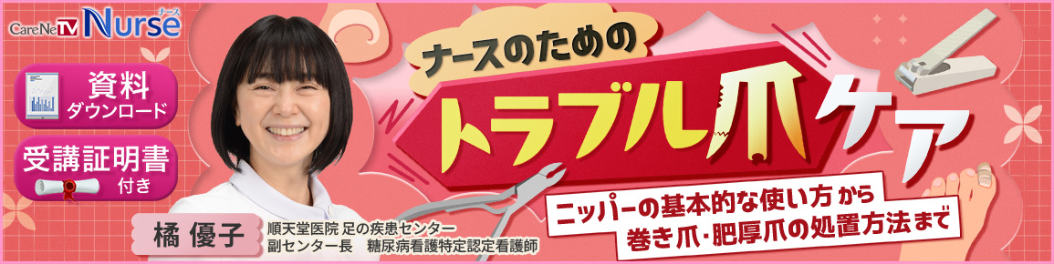 ナースのためのトラブル爪ケア（再配信）